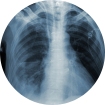 radiologie